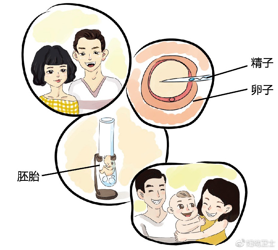 臀位转头位
