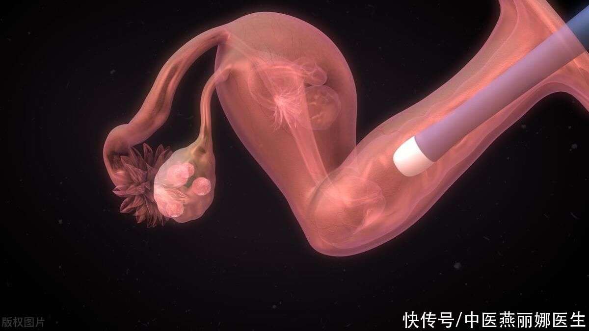 药流
