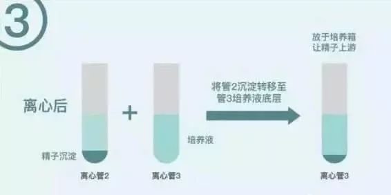 自然流产