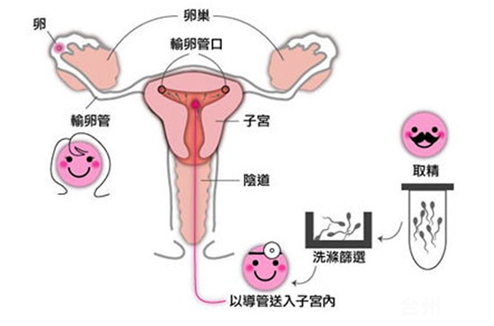 自然怀孕