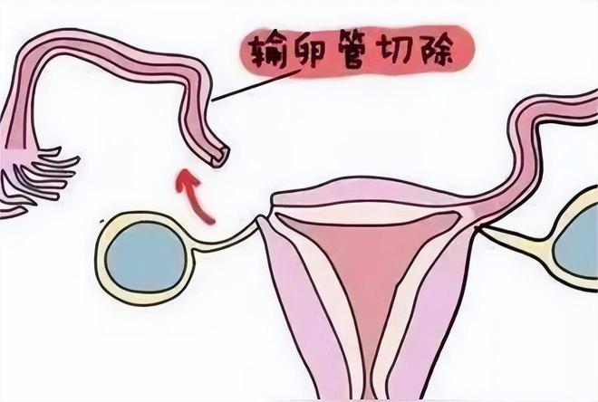臀位孩子