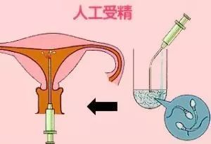 胎停