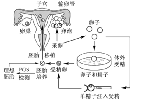 臀位