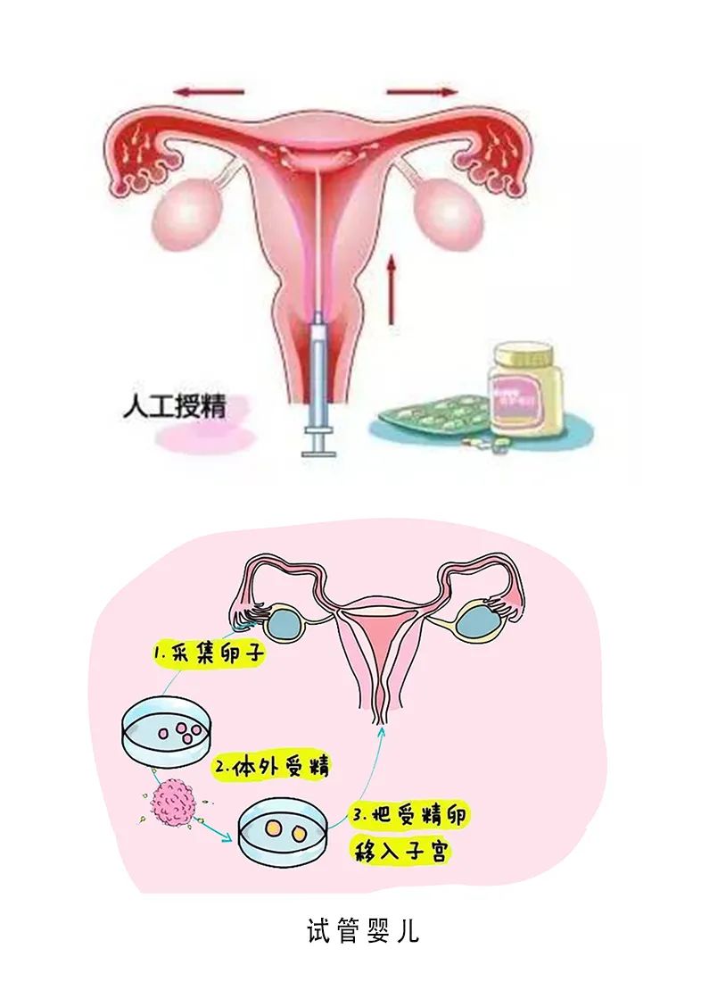 胚胎移植