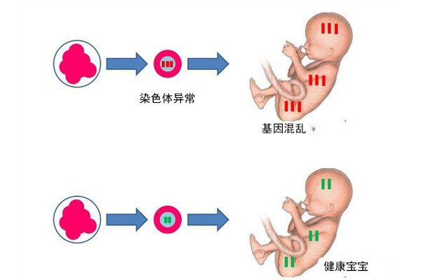 脑瘫