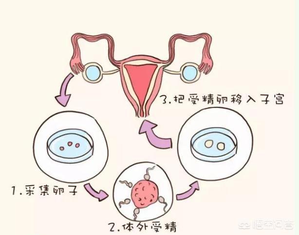 自然流产后