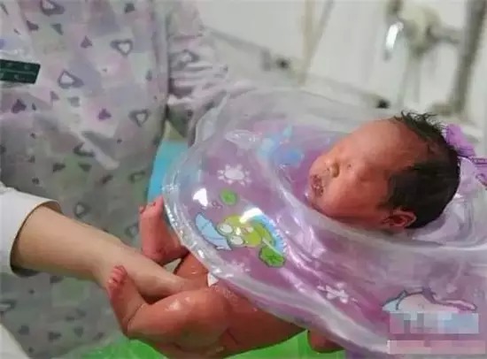 胚胎植入